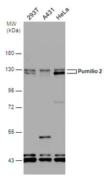 Anti-Pumilio 2 antibody [N1N2], N-term used in Western Blot (WB). GTX107995