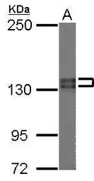 Anti-Pumilio 2 antibody [N1N2], N-term used in Western Blot (WB). GTX107995