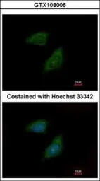 Anti-Protease Inhibitor 15 antibody [C2C3], C-term used in Immunocytochemistry/ Immunofluorescence (ICC/IF). GTX108006