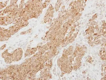 Anti-Protease Inhibitor 15 antibody [C2C3], C-term used in IHC (Paraffin sections) (IHC-P). GTX108006