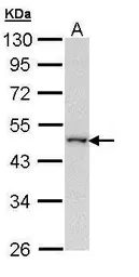 Anti-WWOX antibody [N1N2], N-term used in Western Blot (WB). GTX108011