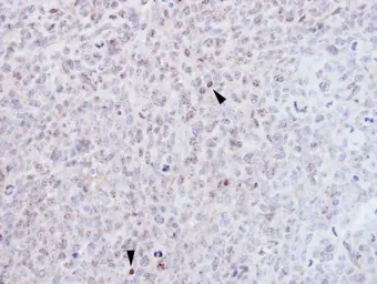 Anti-EZH1 antibody [N1], N-term used in IHC (Paraffin sections) (IHC-P). GTX108013