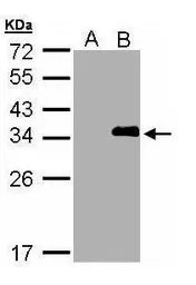 Anti-LASP1 antibody [N1N2], N-term used in Western Blot (WB). GTX108014