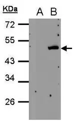 Anti-PSCD4 antibody [N1], N-term used in Western Blot (WB). GTX108032