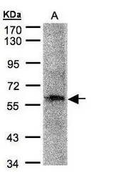 Anti-PRAM1 antibody [C3], C-term used in Western Blot (WB). GTX108042