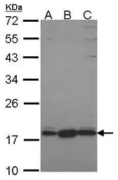 Anti-GNRPX antibody [C1C3] used in Western Blot (WB). GTX108055