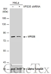 Anti-VPS35 antibody [C3], C-term used in Western Blot (WB). GTX108058