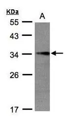 Anti-EFHD2 antibody used in Western Blot (WB). GTX108080