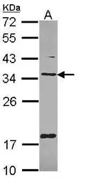Anti-TXNDC1 antibody [C2C3], C-term used in Western Blot (WB). GTX108081