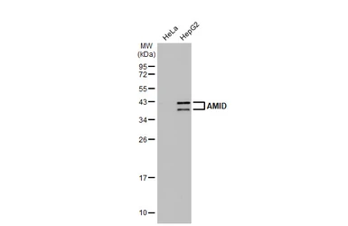 Anti-AMID antibody [N1], N-term used in Western Blot (WB). GTX108089