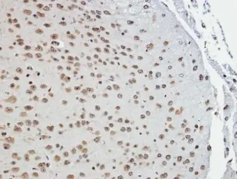 Anti-TAB182 antibody [N1], N-term used in IHC (Paraffin sections) (IHC-P). GTX108091
