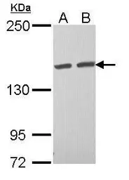Anti-TAB182 antibody [N1], N-term used in Western Blot (WB). GTX108091
