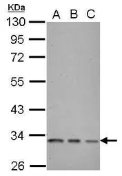Anti-CDC2 antibody [N1], N-term used in Western Blot (WB). GTX108120