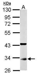Anti-CDC2 antibody [N1], N-term used in Western Blot (WB). GTX108120