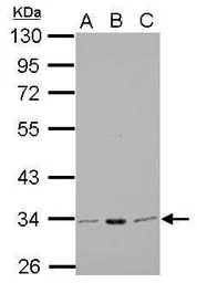 Anti-CDC2 antibody [N1], N-term used in Western Blot (WB). GTX108120