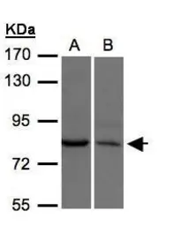 Anti-XPR1 antibody [N1], N-term used in Western Blot (WB). GTX108158