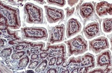 Anti-ERR alpha antibody [N1], N-term used in IHC (Paraffin sections) (IHC-P). GTX108166