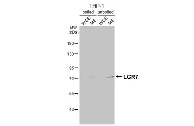 Anti-LGR7 antibody [C3-2], C-term used in Western Blot (WB). GTX108186