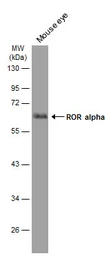 Anti-ROR alpha antibody [C3], C-term used in Western Blot (WB). GTX108201