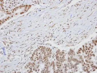 Anti-HUNK antibody [C3], C-term used in IHC (Paraffin sections) (IHC-P). GTX108203