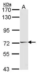 Anti-HUNK antibody [C3], C-term used in Western Blot (WB). GTX108203