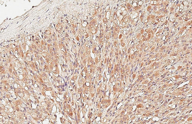 Anti-GALR1 antibody [C2C3], C-term used in IHC (Paraffin sections) (IHC-P). GTX108207