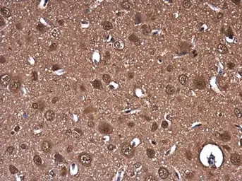 Anti-PTGFRN antibody [C3], C-term used in IHC (Paraffin sections) (IHC-P). GTX108209