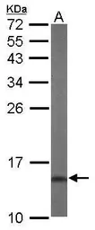 Anti-DUSP23 antibody [C1C3] used in Western Blot (WB). GTX108245