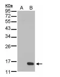 Anti-DUSP23 antibody [C1C3] used in Western Blot (WB). GTX108245