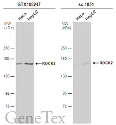 Anti-ROCK2 antibody [N3C1], Internal used in Western Blot (WB). GTX108247