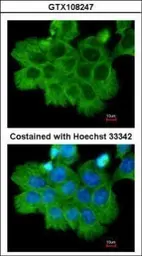 Anti-ROCK2 antibody [N3C1], Internal used in Immunocytochemistry/ Immunofluorescence (ICC/IF). GTX108247