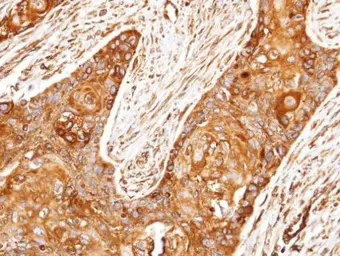 Anti-ROCK2 antibody [N3C1], Internal used in IHC (Paraffin sections) (IHC-P). GTX108247