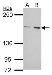 Anti-ROCK2 antibody [N3C1], Internal used in Western Blot (WB). GTX108247