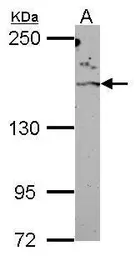 Anti-ROCK2 antibody [N3C1], Internal used in Western Blot (WB). GTX108247
