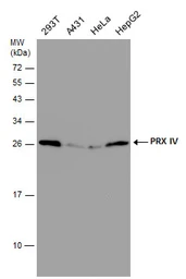 Anti-PRX IV antibody used in Western Blot (WB). GTX108256