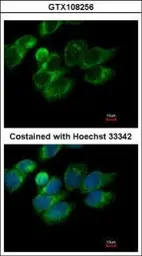 Anti-PRX IV antibody used in Immunocytochemistry/ Immunofluorescence (ICC/IF). GTX108256