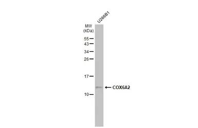 Anti-COX6A2 antibody [N3C3] used in Western Blot (WB). GTX108261