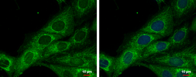 Anti-COX6A2 antibody [N3C3] used in Immunocytochemistry/ Immunofluorescence (ICC/IF). GTX108261