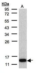 Anti-COX6A2 antibody [N3C3] used in Western Blot (WB). GTX108261