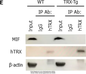 Anti-Thioredoxin antibody [N3C3] used in Western Blot and Immunoprecipitation (WB IP). GTX108263