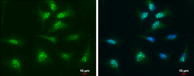 Anti-Thioredoxin antibody [N3C3] used in Immunocytochemistry/ Immunofluorescence (ICC/IF). GTX108263