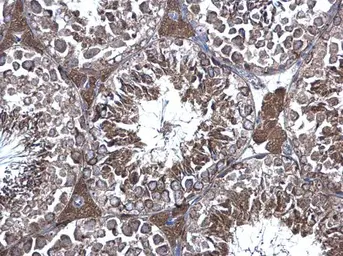Anti-eRF1 antibody used in IHC (Paraffin sections) (IHC-P). GTX108271