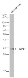 Anti-MPST antibody [C2C3], C-term used in Western Blot (WB). GTX108274