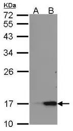 Anti-REG III alpha antibody [C1C3] used in Western Blot (WB). GTX108275