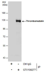Anti-Thrombomodulin antibody [C3], C-term used in Immunoprecipitation (IP). GTX108277