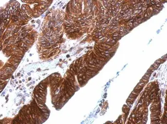 Anti-Thrombomodulin antibody [C3], C-term used in IHC (Paraffin sections) (IHC-P). GTX108277