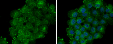Anti-Thrombomodulin antibody [C3], C-term used in Immunocytochemistry/ Immunofluorescence (ICC/IF). GTX108277