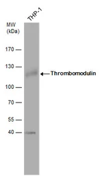 Anti-Thrombomodulin antibody [C3], C-term used in Western Blot (WB). GTX108277