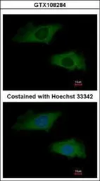 Anti-interferon alpha 2 antibody [C1C3] used in Immunocytochemistry/ Immunofluorescence (ICC/IF). GTX108284