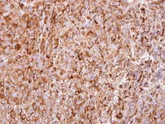 Anti-interferon alpha 2 antibody [C1C3] used in IHC (Paraffin sections) (IHC-P). GTX108284